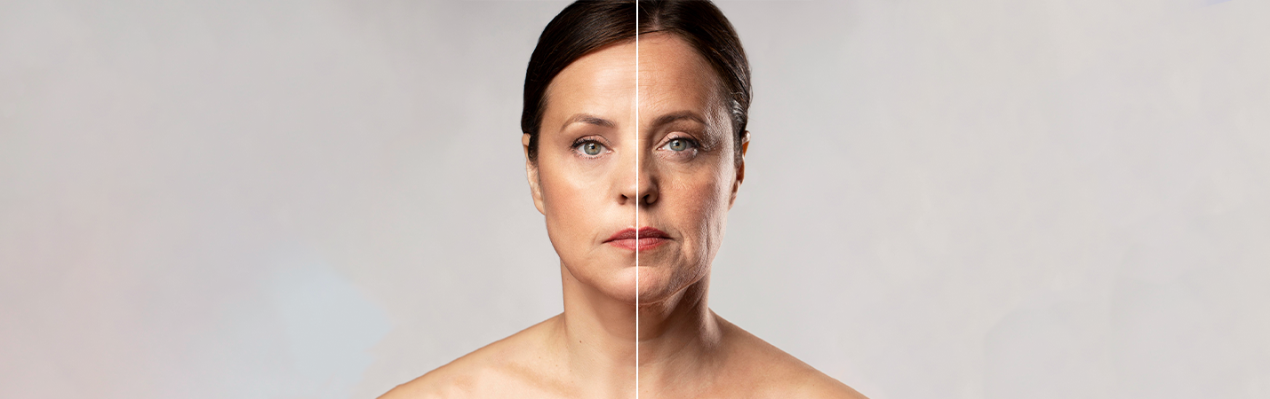 Yanak Sarkması Nasıl Önlenir?